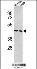 Anti-TUFM (N-term) Antibody