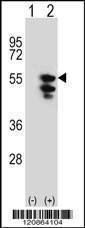 Anti-TUFM (N-term) Antibody