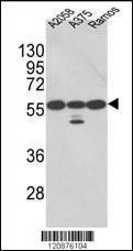 Anti-PDIA3 (Center) Antibody