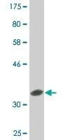 Anti-GDF7 Antibody