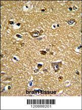Anti-PRDX2 (C-term) Antibody