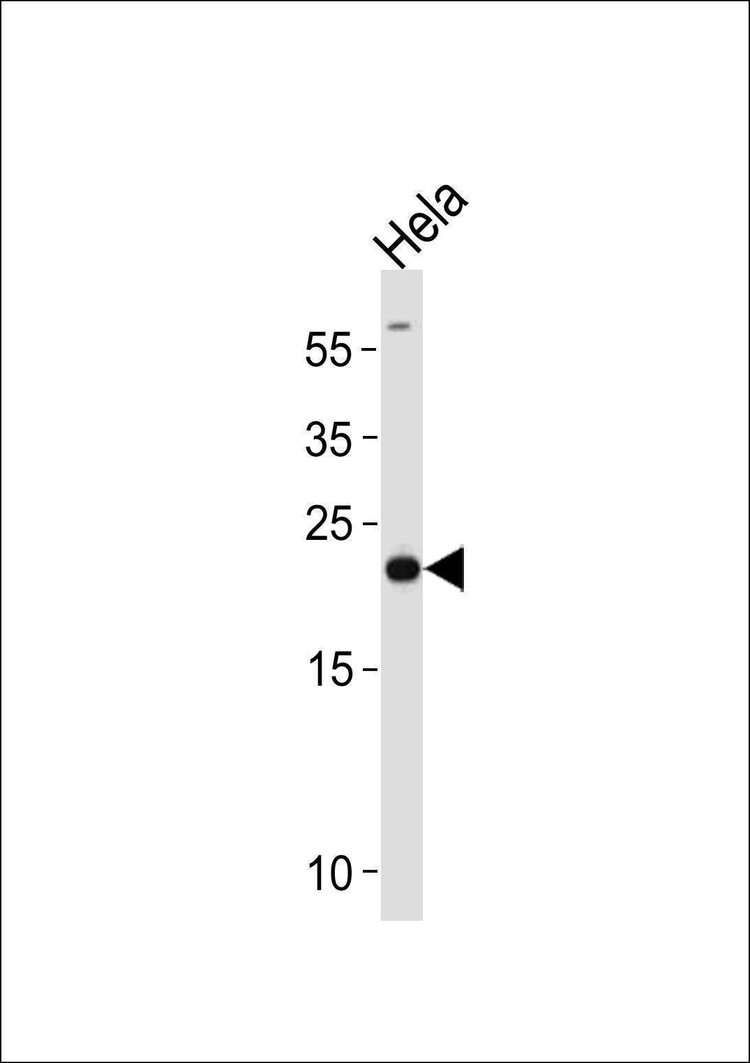 Anti-PRDX2 (Center) Antibody