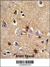 Anti-PRDX6 (C-term) Antibody