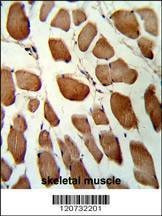 Anti-GSTO1 (Center) Antibody