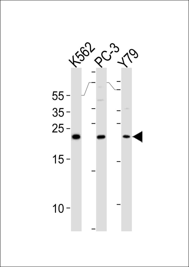 Anti-GSTP1 (C-term) Antibody