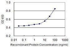 Anti-GEMIN7 Antibody