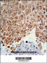 Anti-PHGDH (Center) Antibody