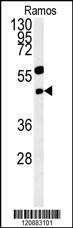 Anti-PHGDH (Center) Antibody