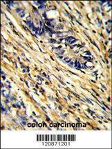 Anti-YWHAG (Center) Antibody