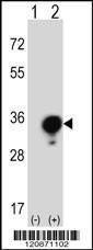 Anti-YWHAG (Center) Antibody
