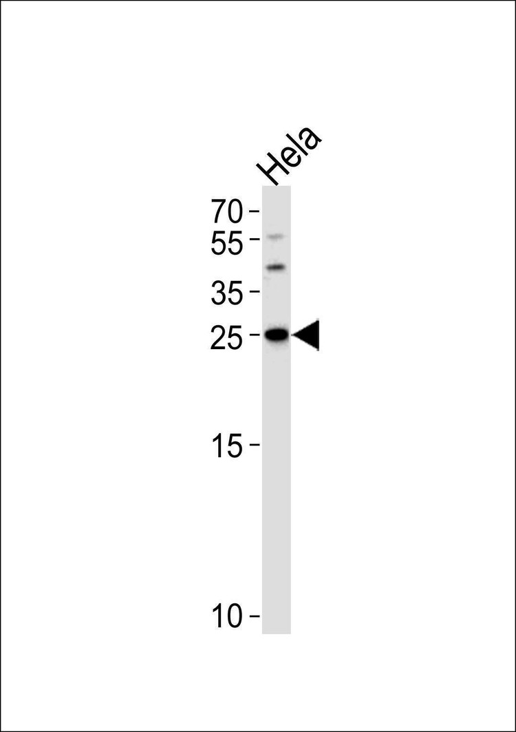Anti-YWHAG (Center) Antibody