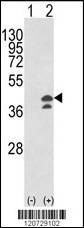 Anti-GOT1 (N-term) Antibody