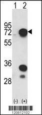 Anti-HNRPL (C-term) Antibody