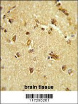 Anti-RBM14 (Center) Antibody