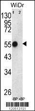 Anti-ATP5B (Center) Antibody