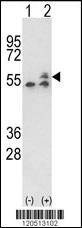 Anti-ATP5B (Center) Antibody