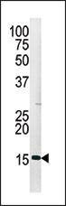 Anti-Phospho-H3 (S28) Antibody