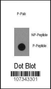 Anti-Phospho-ABL1 (Y134) Antibody