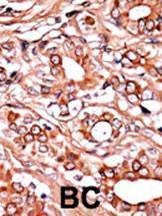Anti-Phospho-ABL1 (Y134) Antibody