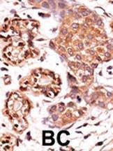 Anti-Phospho-ABL (Y412) Antibody
