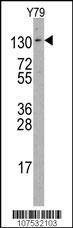 Anti-ABL2 (R432) Antibody