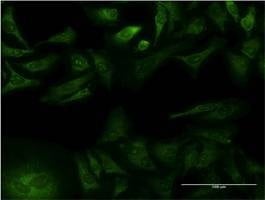 Anti-GFRA1 Antibody