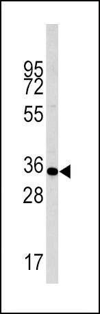 Anti-Phospho-Caspase 6 (S257) Antibody