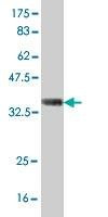 Anti-GGPS1 Antibody