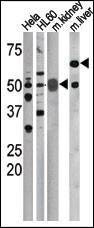 Anti-Phospho-CDC25A (S75) Antibody
