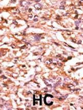 Anti-Phospho-CDC25B (S187) Antibody