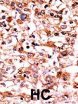 Anti-Phospho-CDK1 (S39) Antibody