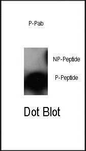 Anti-Phospho-cJun (S63) Antibody