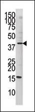 Anti-Phospho-cJun (S63) Antibody