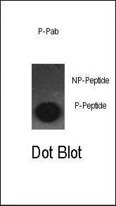 Anti-Phospho-cJun (S63) Antibody