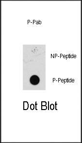 Anti-Bi-Phospho-MEK1 (S218/222) Antibody