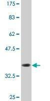 Anti-GIMAP5 Antibody