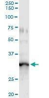 Anti-GIMAP5 Antibody
