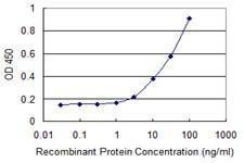 Anti-GIMAP5 Antibody