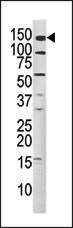 Anti-Phospho-MET (Y1349) Antibody
