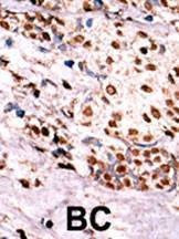 Anti-Phospho-MET (Y1349) Antibody