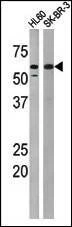 Anti-Phospho-MYT1 (T495) Antibody