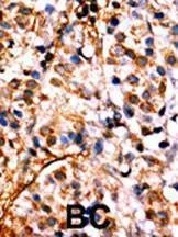Anti-Phospho-NFKB (S536) Antibody