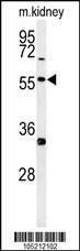 Anti-Phospho-NFKB (S536) Antibody