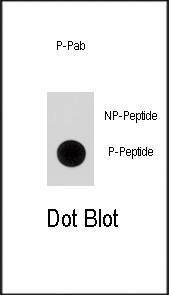 Anti-Phospho-p21Cip1 (S130) Antibody