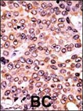 Anti-Phospho-P21CIP1 (T145) Antibody