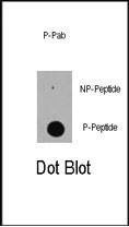 Anti-Phospho-EP300 (S89) Antibody