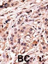 Anti-Phospho-p53 (S20) Antibody