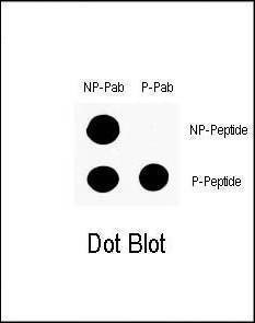 Anti-Phospho-P53 (S9) Antibody