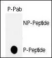 Anti-Phospho-p53 (T18) Antibody