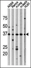 Anti-Phospho-p53 (T18) Antibody